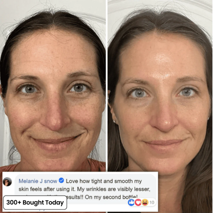 Collagen Plump & Repair Volufiline Balm